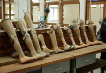 မြစ်ကြီးနားဆေးရုံကြီးတွင် ခြေတုနှင့်လက်တုများ လာရောက်တပ်ဆင်ကြရန် ပြည်နယ်မသန်စွမ်းအသင်း ဖိတ်ခေါ် ကခ်င္ျပည္နယ္ မသန္စြမ္း