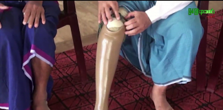 မိုးညှင်းမြို့နယ်အတွင်းရှိ မသန်စွမ်းသူများအတွက် ပညာရေးနှင့် အသက်မွေးဝမ်း ကျောင်းမှုများ အခက်အခဲဖြစ်နေ mohnyin