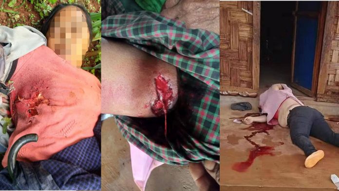 လက်နက်ကြီးကျည်ထိမှန်