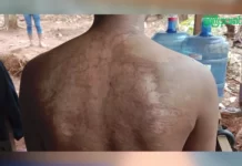 စစ်ကောင်စီ၏ ဖမ်းဆီခြင်းခံရပြီး စစ်ကြောရေး၊အကျဉ်းထောင်များတွင် ညင်းပန်းနှိပ်စက်ခံခဲ့ရသည့် ဖားကန့်ပြည်သူတစ်ဦး။