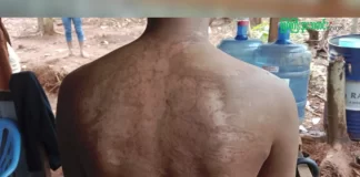 စစ်ကောင်စီ၏ ဖမ်းဆီခြင်းခံရပြီး စစ်ကြောရေး၊အကျဉ်းထောင်များတွင် ညင်းပန်းနှိပ်စက်ခံခဲ့ရသည့် ဖားကန့်ပြည်သူတစ်ဦး။