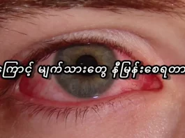ဘာကြောင့် မျက်သားတွေနီမြန်းစေရတာလဲ။ ဘာကြောင့် မျက်သားတွေနီမြန်းရတာလဲ။