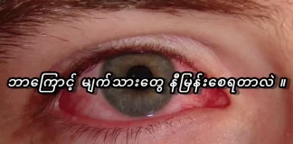 ဘာကြောင့် မျက်သားတွေနီမြန်းစေရတာလဲ။ ဘာကြောင့် မျက်သားတွေနီမြန်းရတာလဲ။