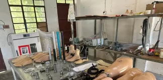 နွေဦးတော်လှန်ရေးမှာ ကိုယ်လက်အင်္ဂါ ဆုံးရှုံးခဲ့တဲ့ အယောက် ၄၀၀ ကျော်ကို NRC က ခြေတုအခမဲ့တပ်ဆင်ပေး